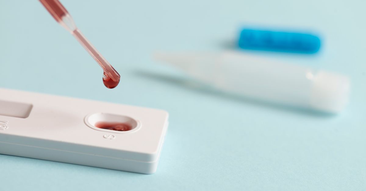 How can I check my cholesterol level at home? Test2Go